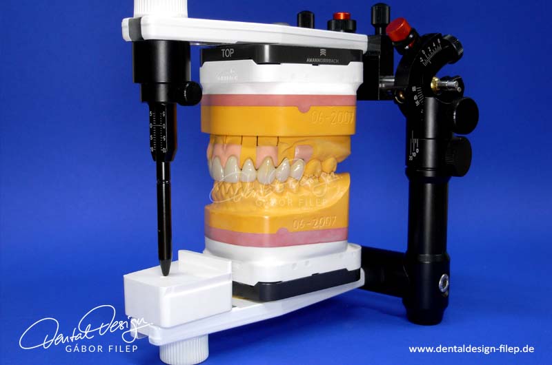 800x_meisterarbeit_06_dentaldesign-filep